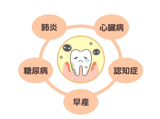 全身の病気と歯周病の関係